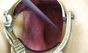 एल्मर के पत्नी से मो ...