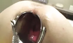 गुदा, विशाल अऊर क्रू ...