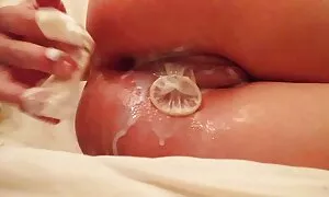 एचडी मा शुक्राणु के  ...